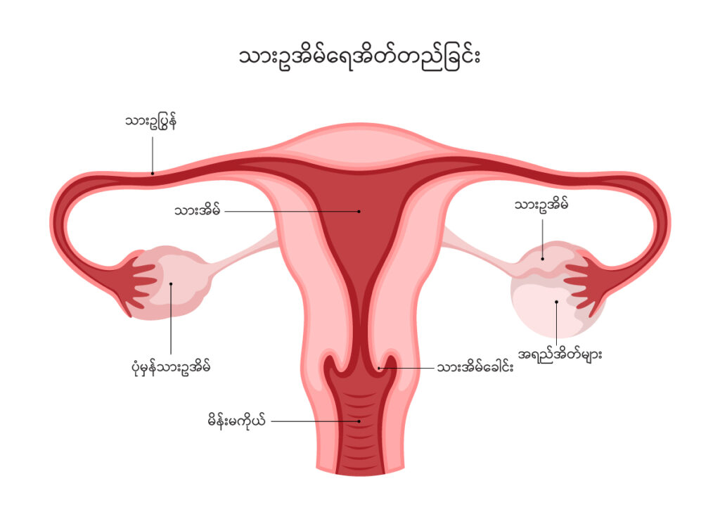 Ovarian cyst IMG 1