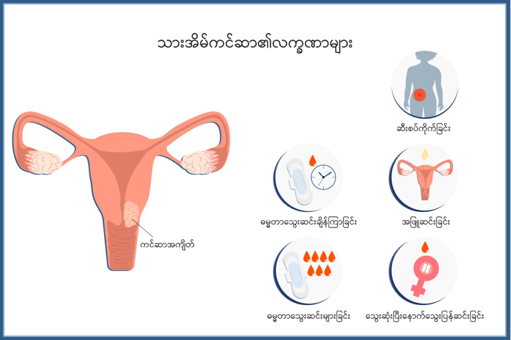 Uterine Cancer IMG 1