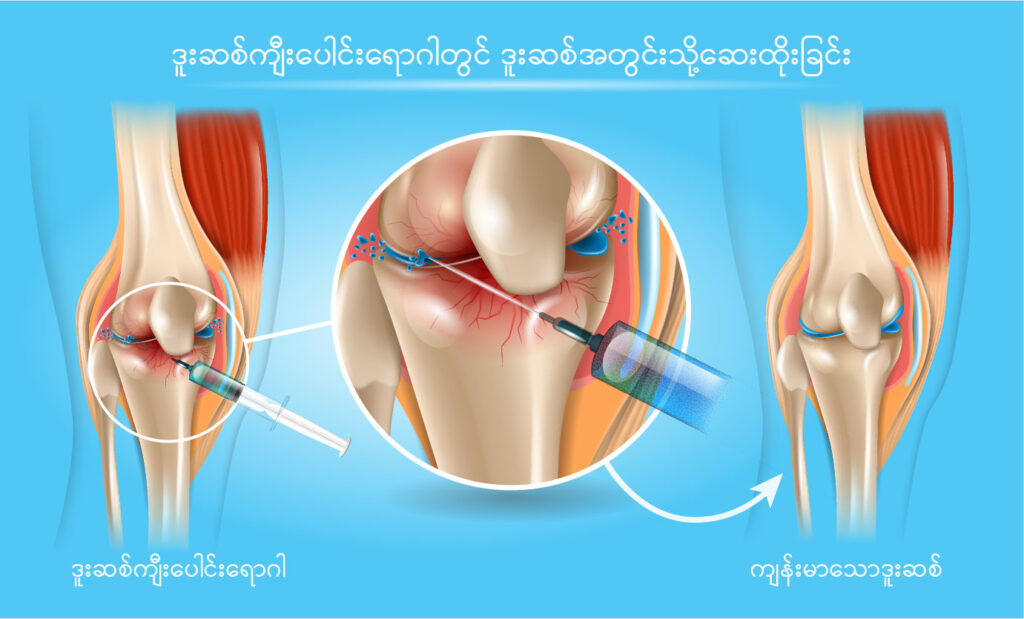 Joint Injections IMG 1