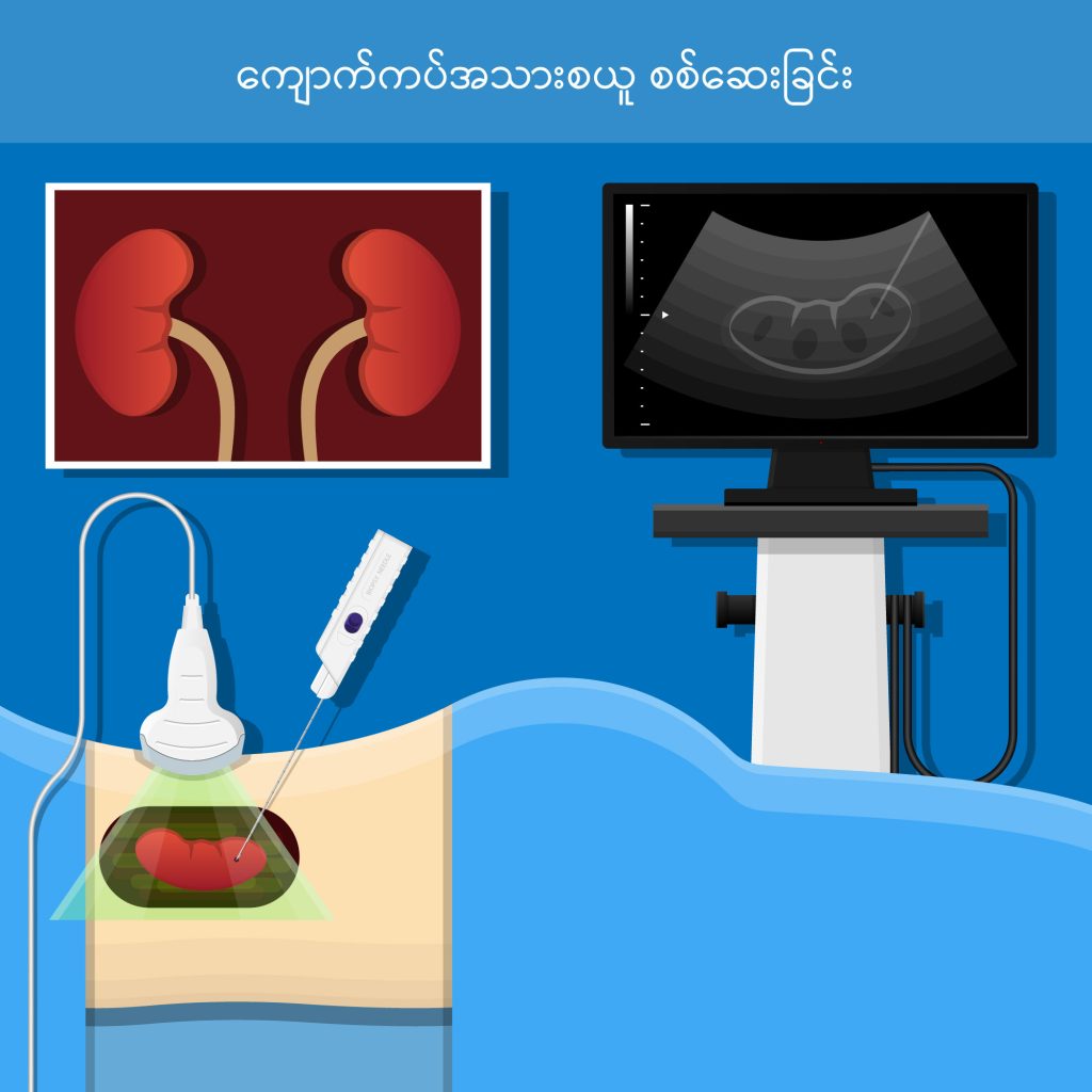 Renal Biopsy IMG1