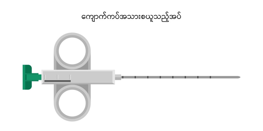 Renal Biopsy IMG2