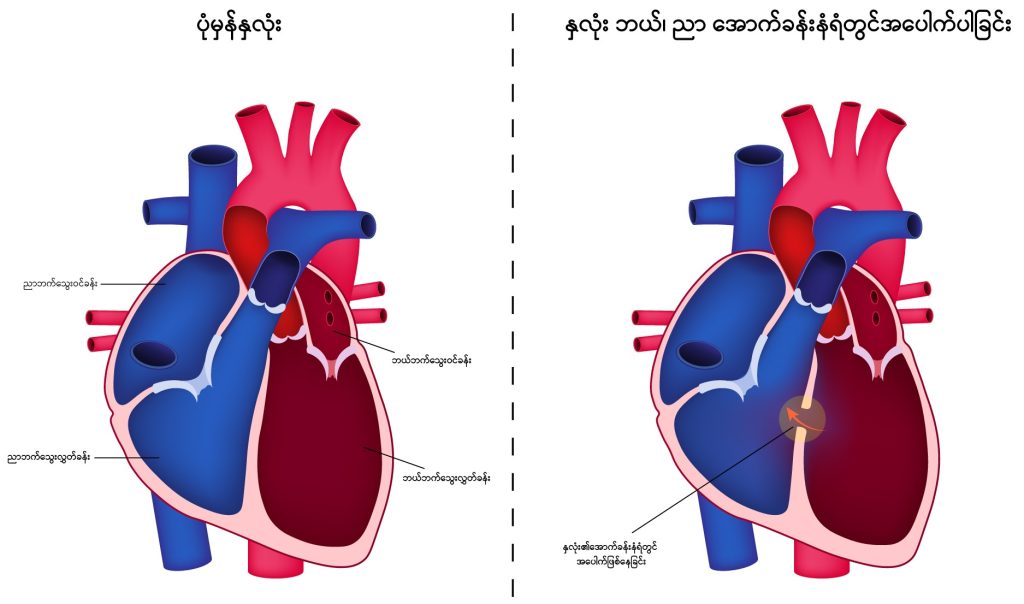 Congenital heart diseases image