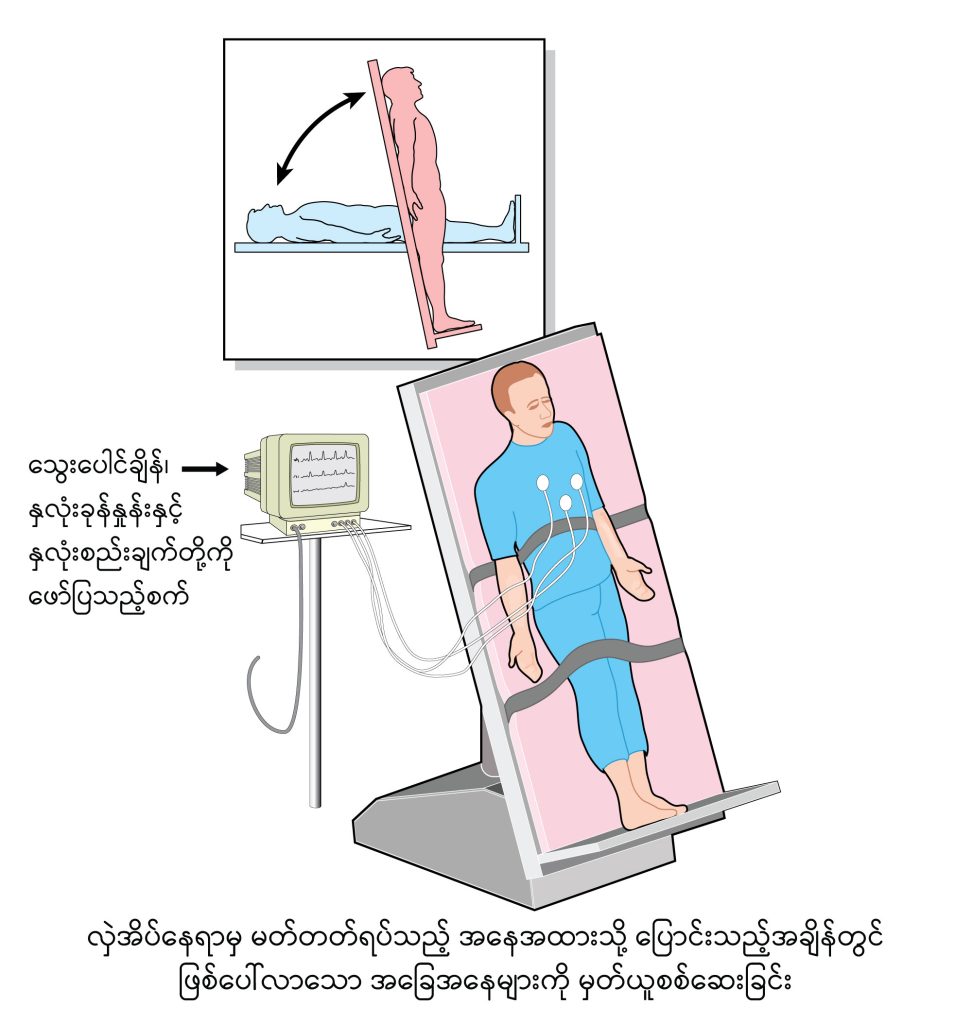 Syncope image