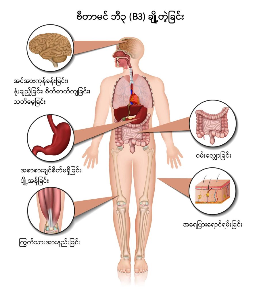 Pellagra IMG1