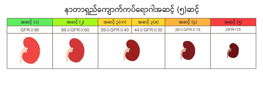 Chronic kidney disease image