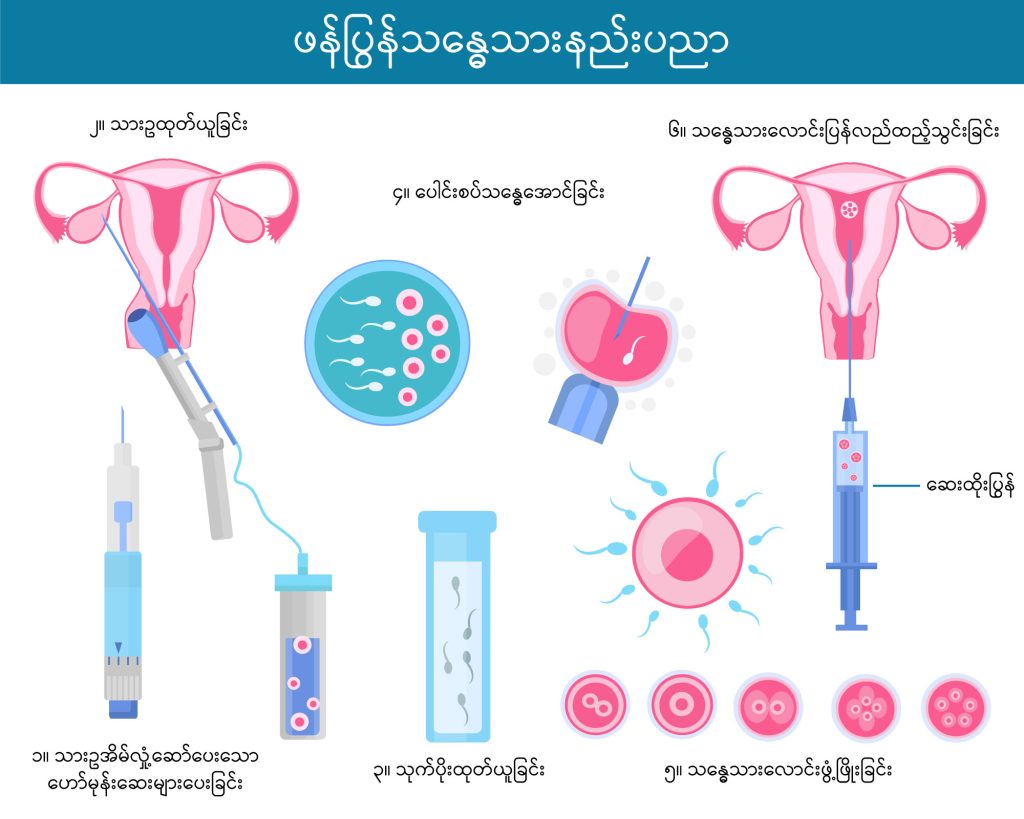 In vito fertilization image2