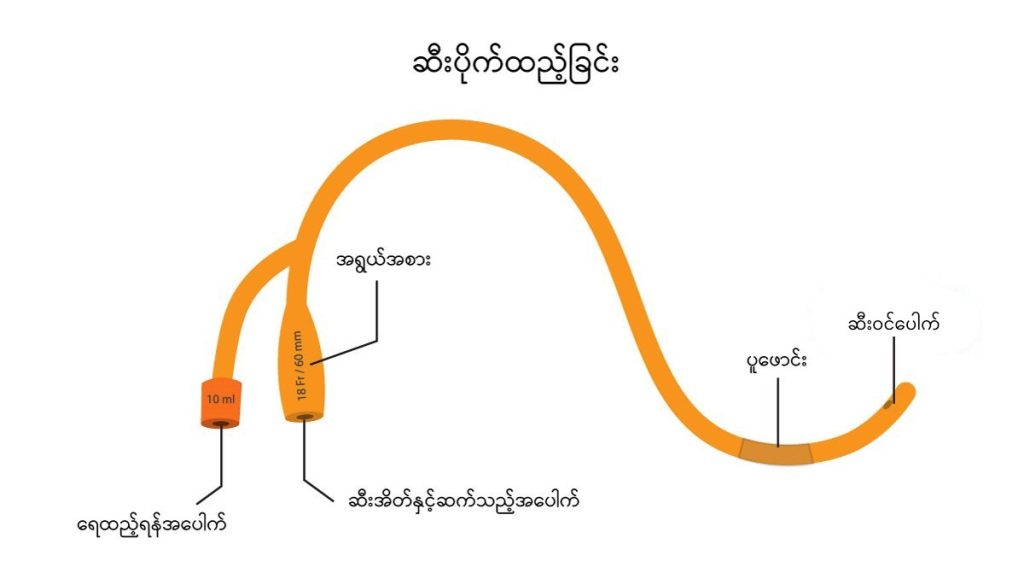 Urinary catheterisation image1