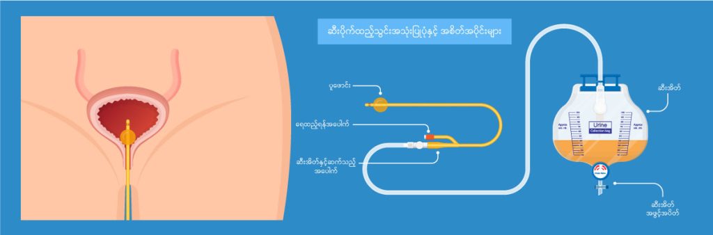 Urinary catheterisation image2