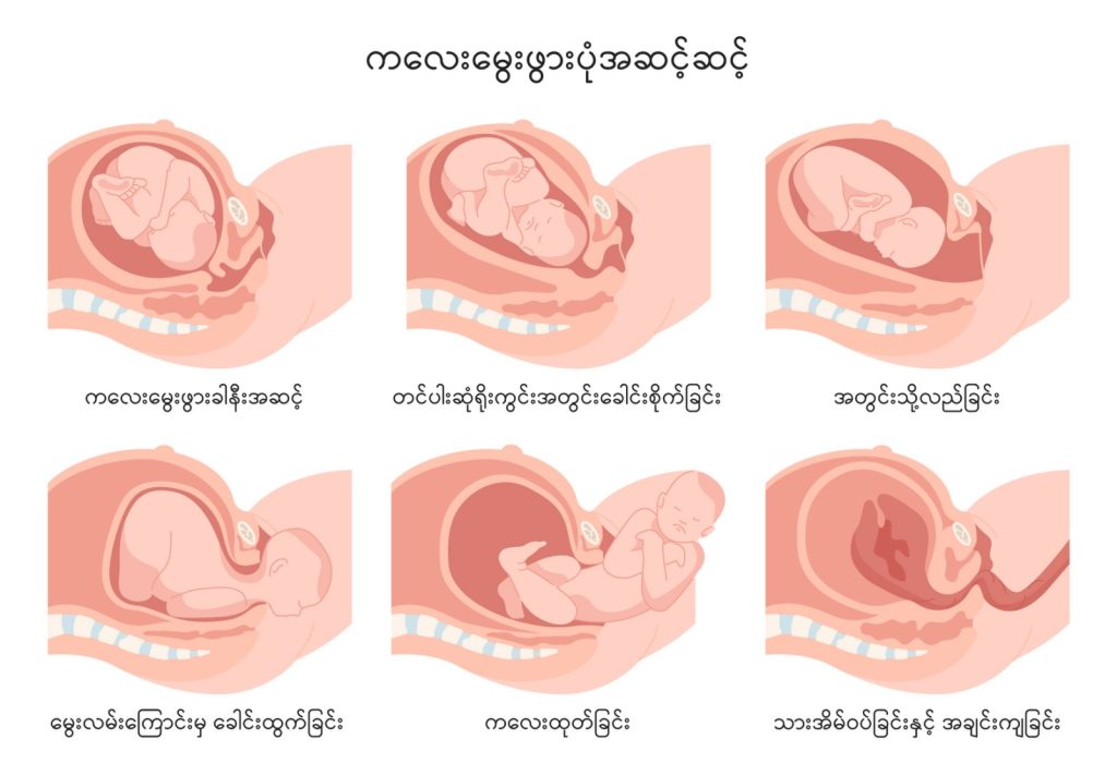 Normal vaginal delivery image1