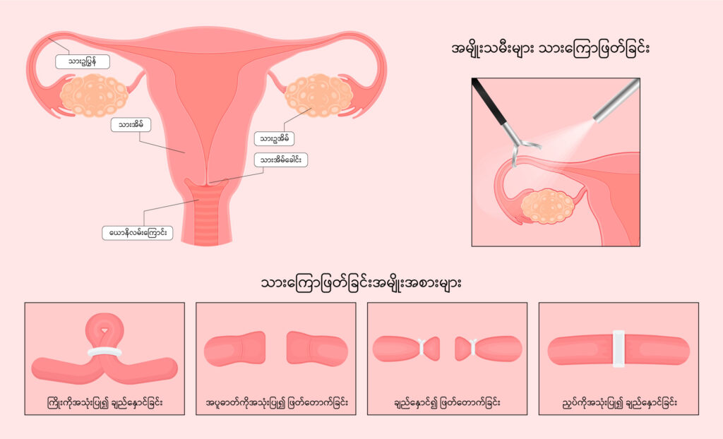 Sterilization image