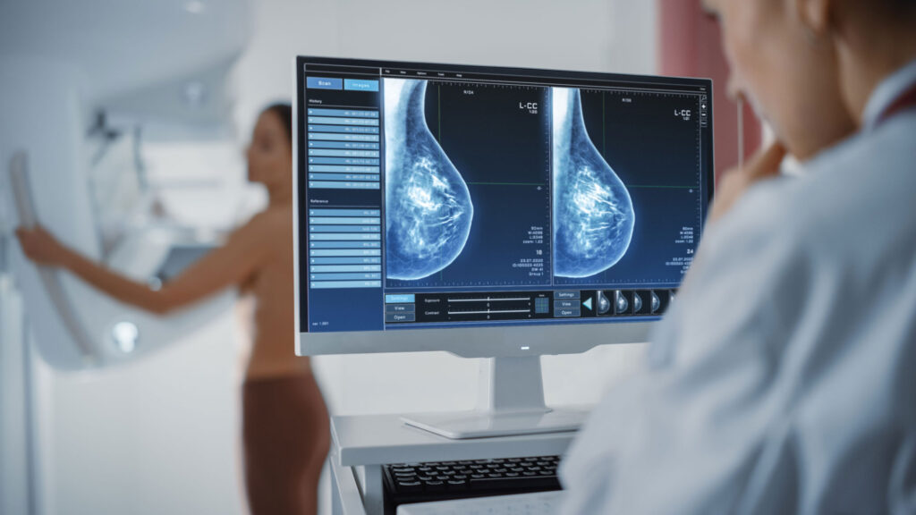 Mammogram image 1