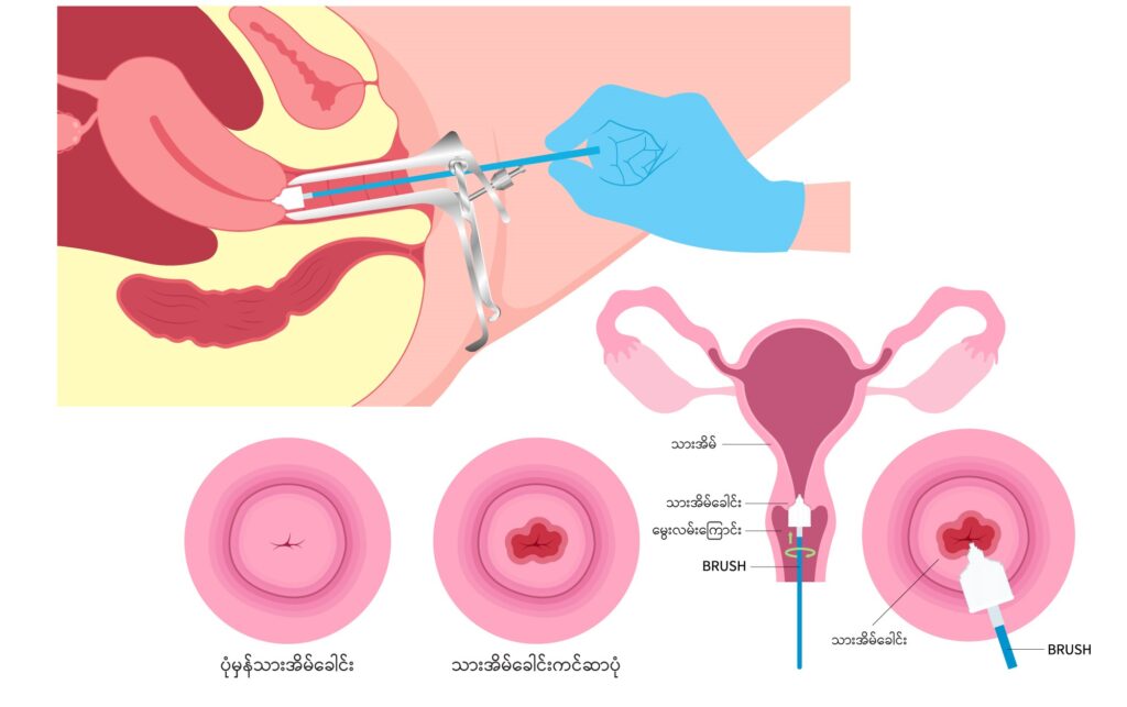 Pap smear image1