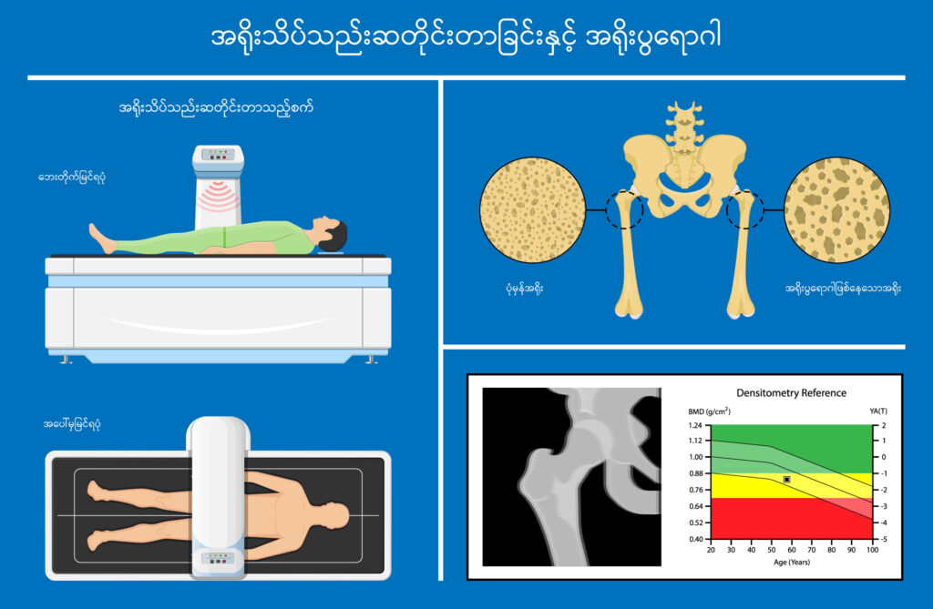 Bone Density Test image